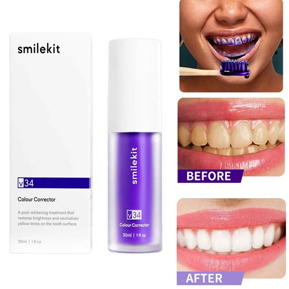 Blanqueador Dental SmileKit v34™