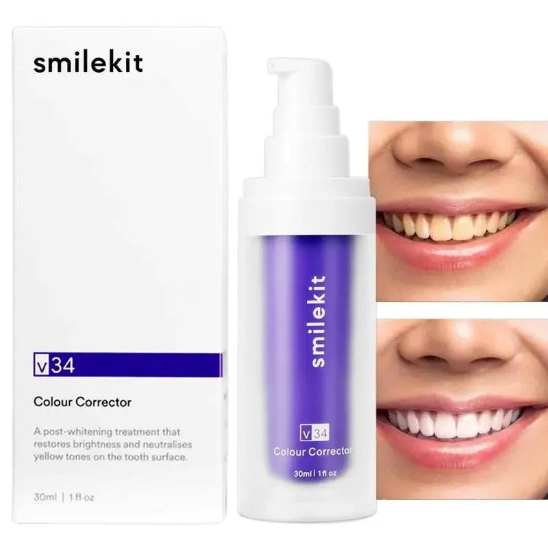 Blanqueador Dental SmileKit v34™